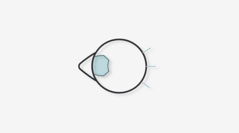 Causes Of Umbilical Hernia