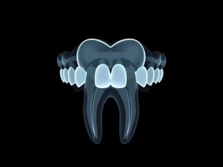 Why Does Hydrogen Peroxide Whiten Teeth