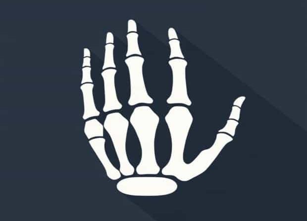 Is It Metacarpal Or Metacarpus