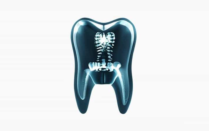 Dental X Rays And Hypothyroidism