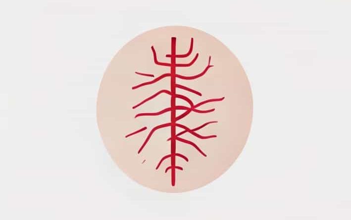 Visual Infusion Phlebitis Score Pdf