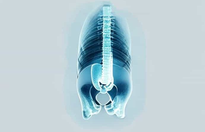 X Ray Symphysis Pubis