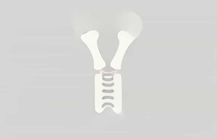 Zimmer Proximal Femur Replacement