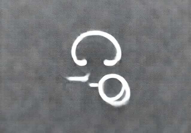 Are Cold Sores Contagious When Scabbed