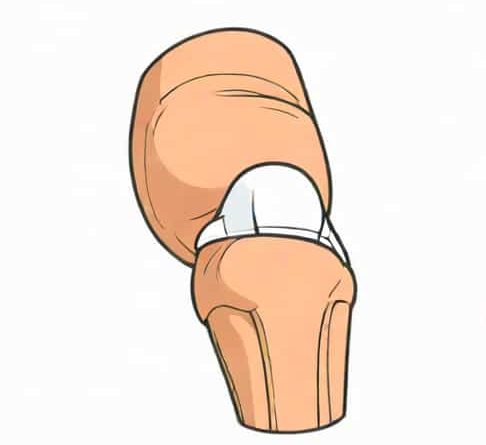 Best Collagen For Knee Cartilage Repair