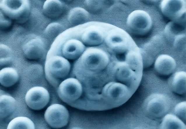 Foam Cells Are Macrophages That Engulf