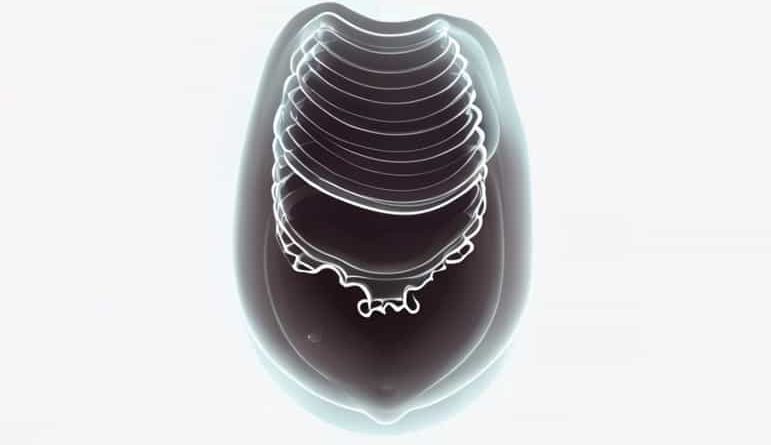 Gaseous Distention Of The Stomach Xray