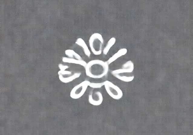 Is The Causative Organism Of Diphtheria