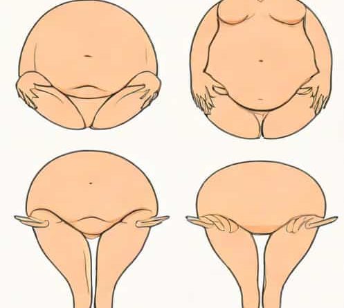 Labiaplasty Before And After Childbirth