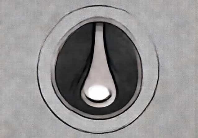 Thyroglossal Cyst Embryological Origin