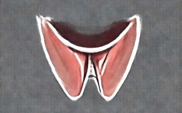 Unilateral Tonsillar Enlargement Causes