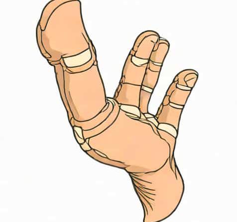 Ulnar Base Of Proximal Phalanx