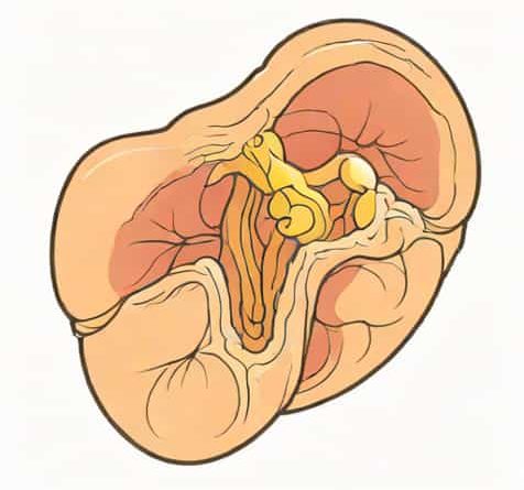 What Is A Branchial Cleft Cyst