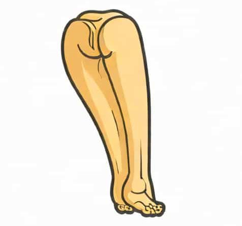Upper End Of Femur